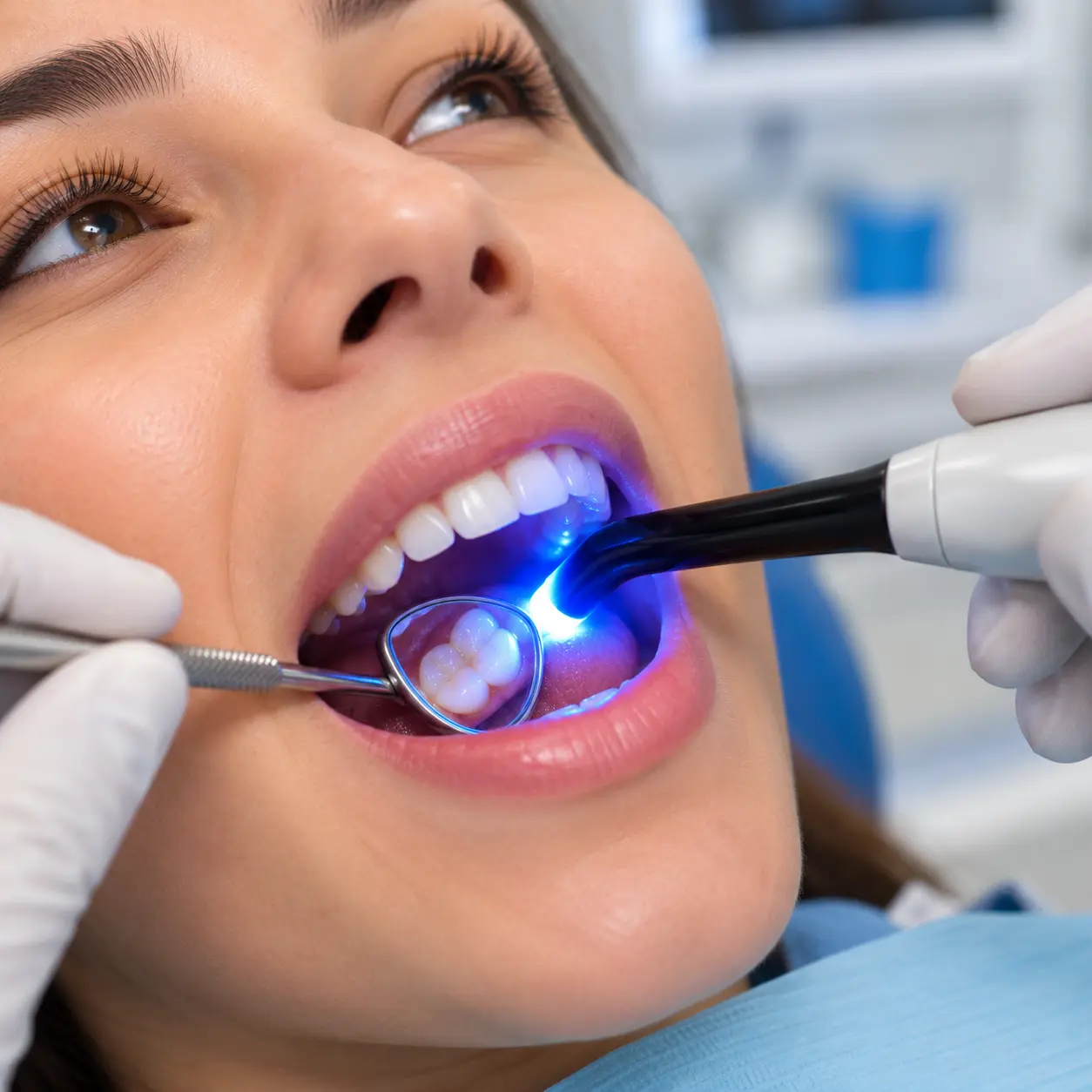 Dental Fillings